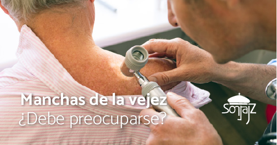 Manchas de la vejez ¿Cuándo hay que preocuparse?